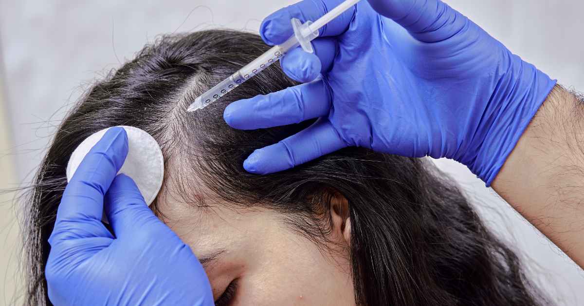 Hair Loss Treatment in Multan - Dr Farooq Haider Qaisrani