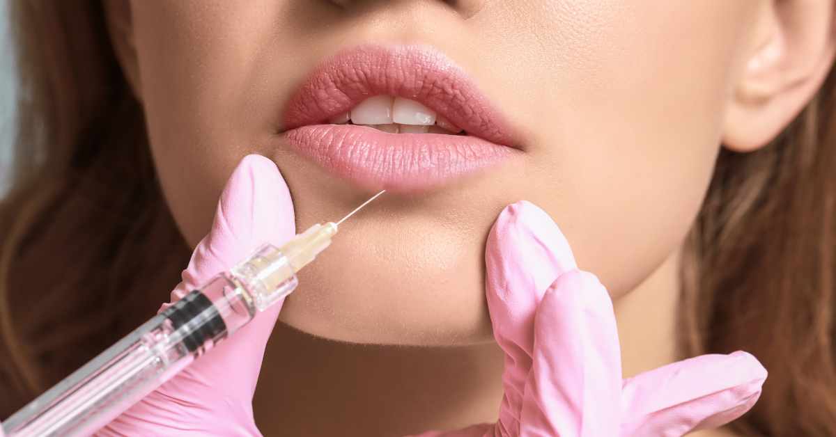 Lip Fillers Treatment in Multan