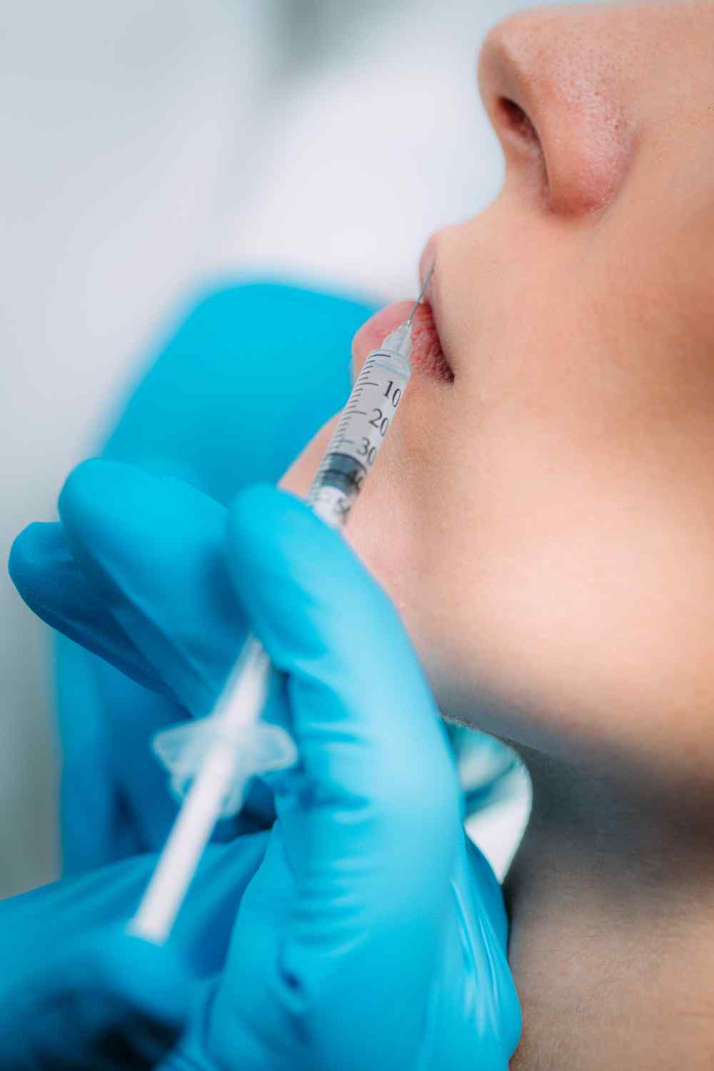Lip Fillers in Multan