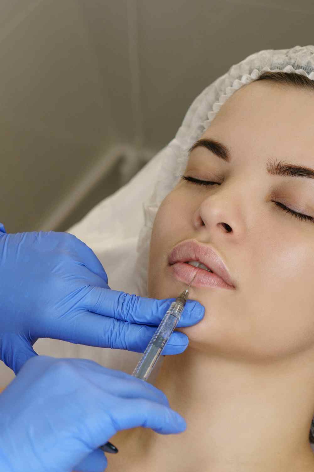 Lip Fillers
