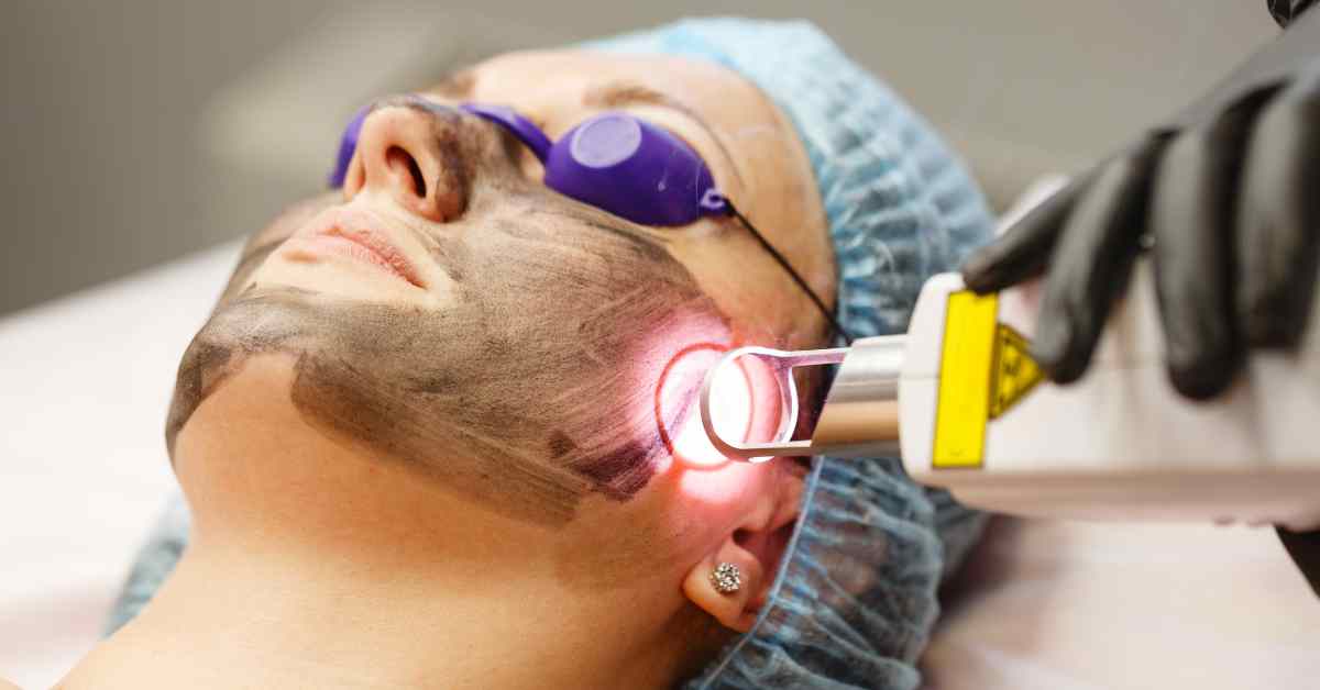 Skin Rejuvenation Treatment in Multan