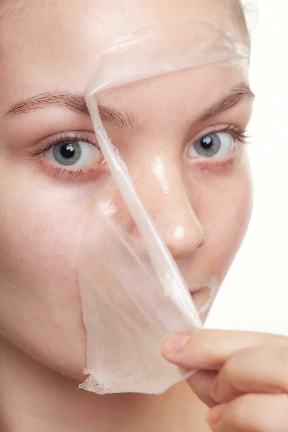 Types of Chemical Skin Peel Treatment