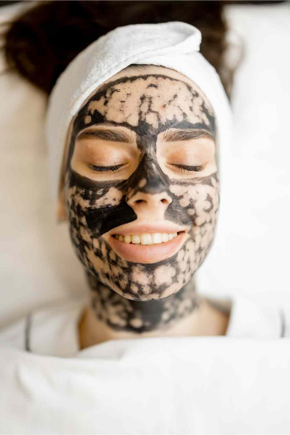 What is the process of carbon laser peel?