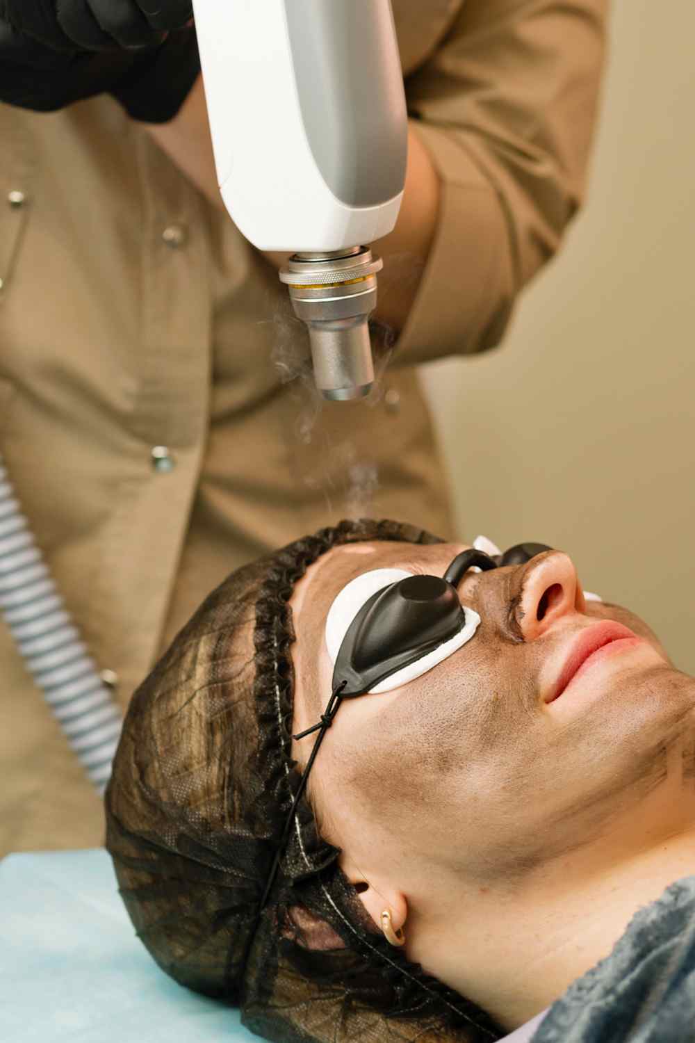 Where to get carbon laser peel treatment in Multan